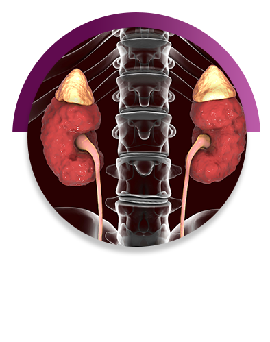 Adrenal and Steroid Hormone Disorders Treatment in Vijayawada