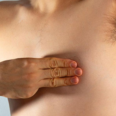 Gynecomastia Treatment in Vijayawada