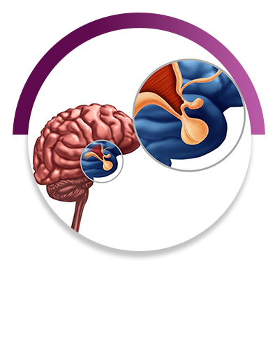 Pituitary Disorder Treatment in Vijayawada