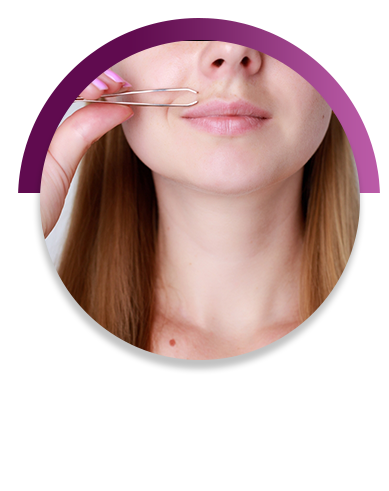 Hirsutism Treatment in Vijayawada 